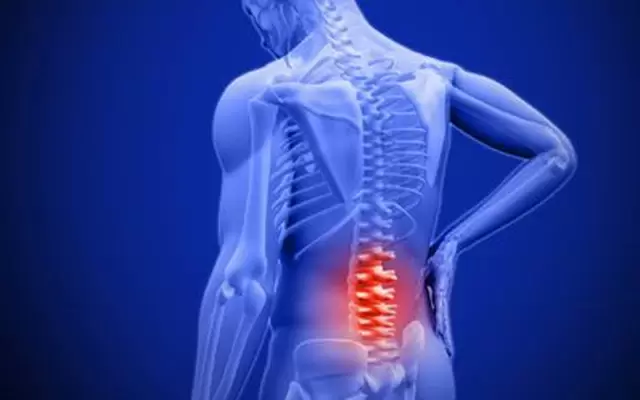 Viêm cột sống dính trục (Viêm cột sống dính khớp)