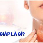 TUYẾN GIÁP – “CỖ MÁY NHỎ” ẢNH HƯỞNG ĐẾN CẢ CƠ THỂ